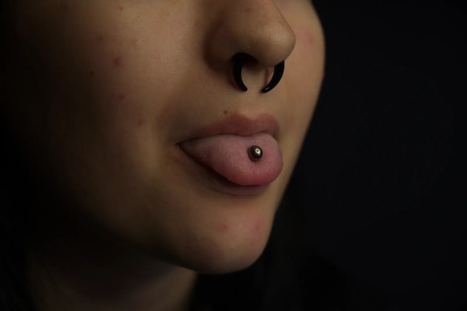 Septum a jazyk